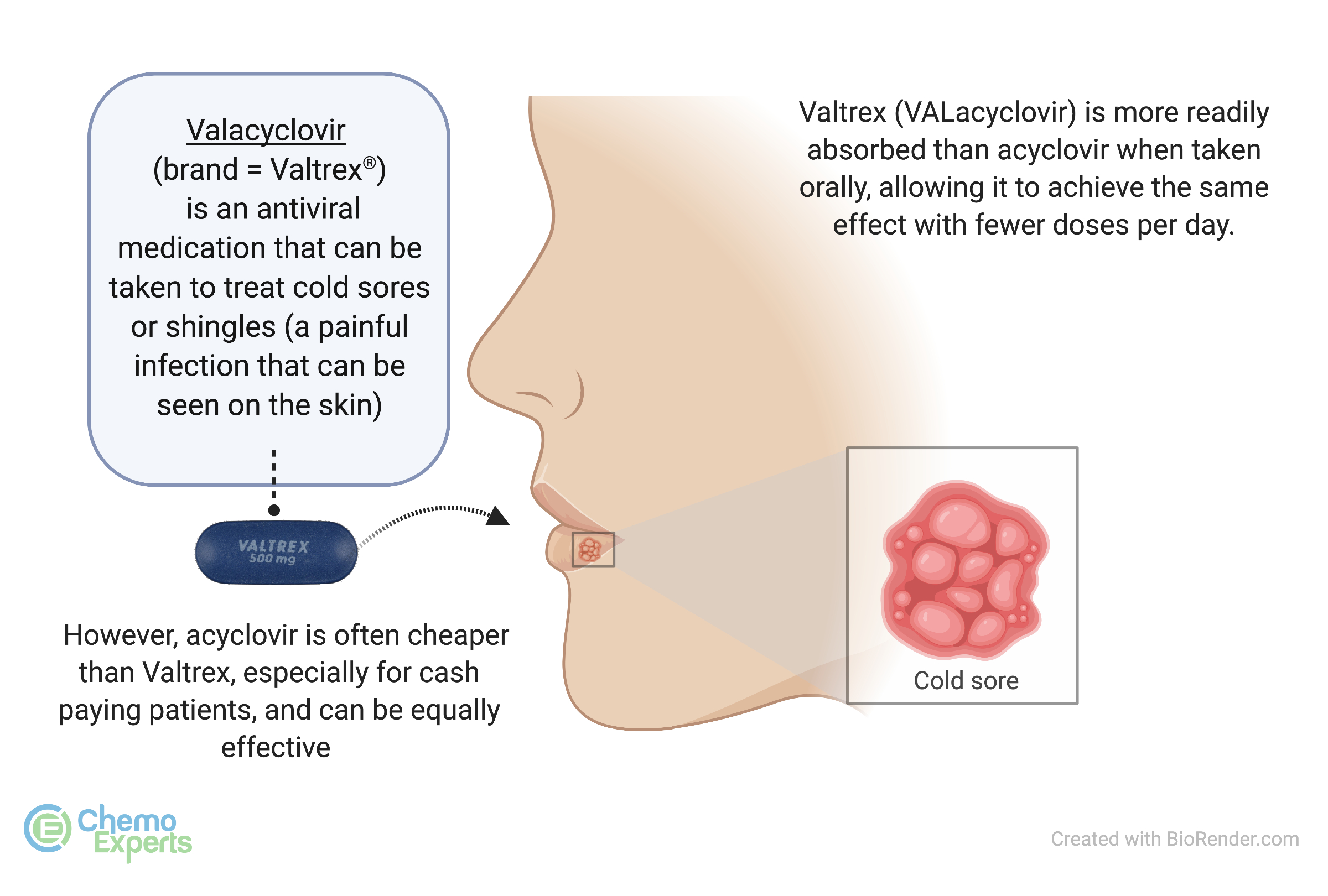 Cold Sores ChemoExperts