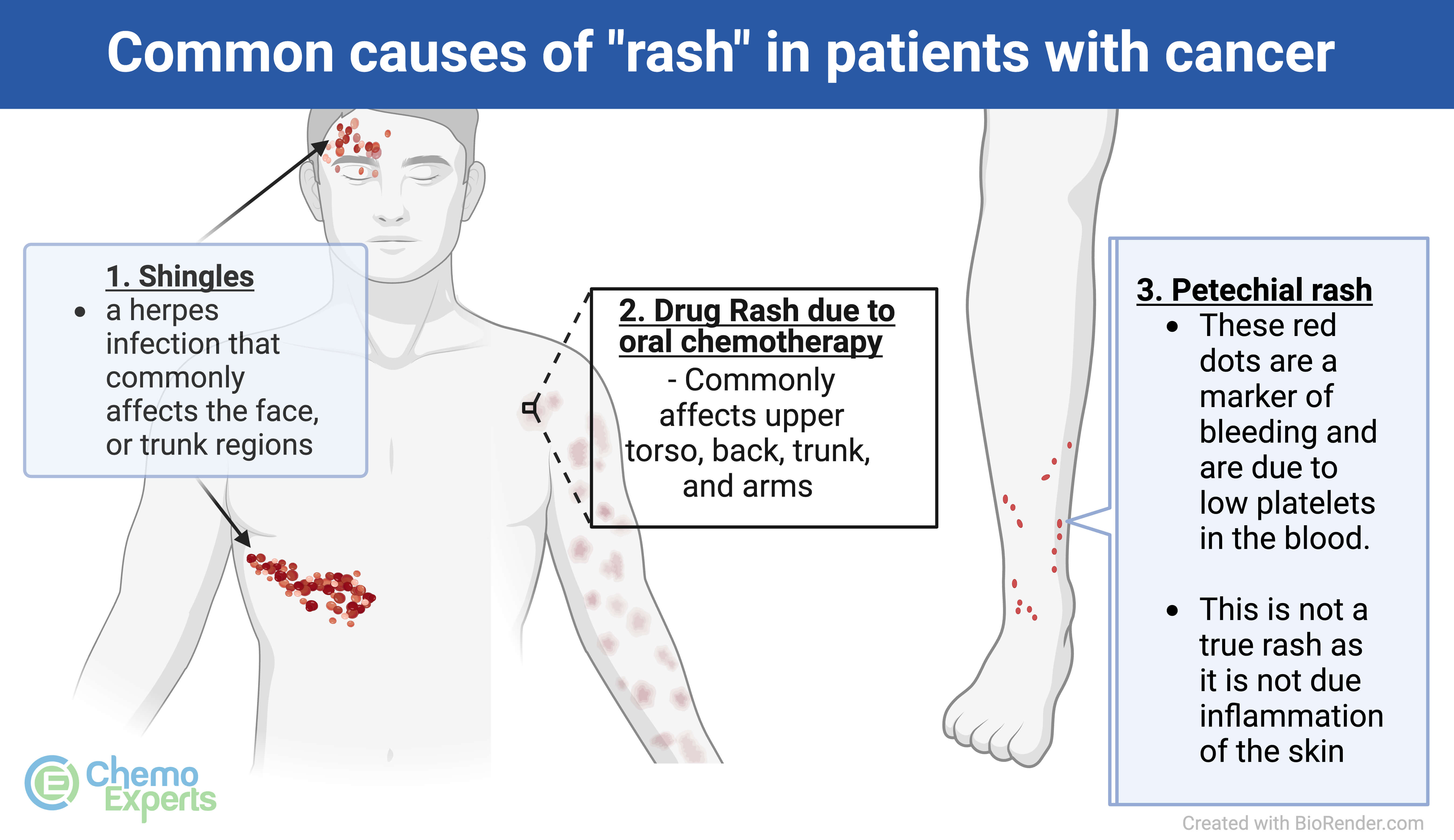 What is Chemo Rash?